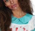ZOMBIE NURSE 42 44 (79004)